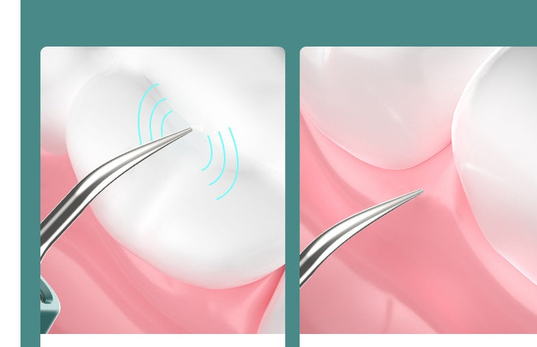 New High-definition Visual Dental Cleaner With Camera